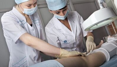 Surgical treatment of varicose veins